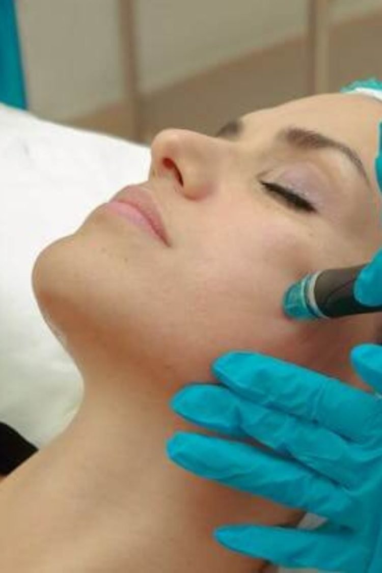 A woman is getting microneedling: How long does microneedling last?